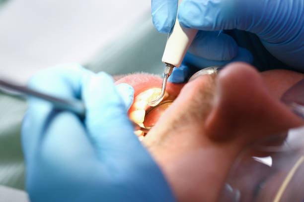 Best Orthodontic Emergency Dentist in Seabrook Island, SC