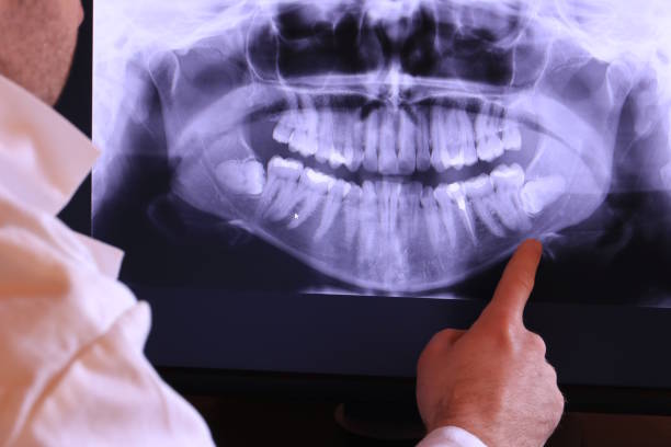 Best Emergency Dentist for Knocked-Out Tooth in Seabrook Island, SC