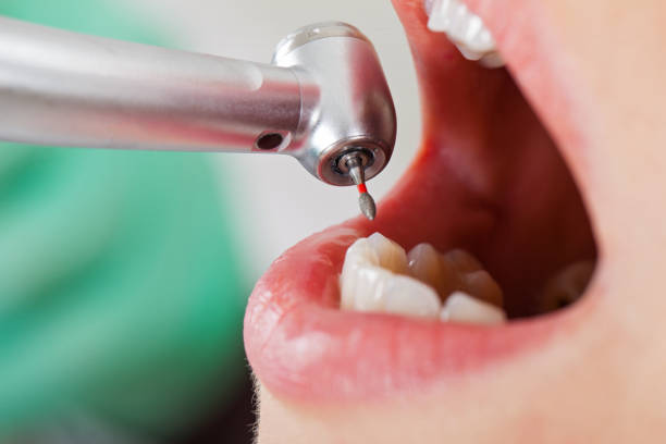 Best Mobile Emergency Dentist in Seabrook Island, SC